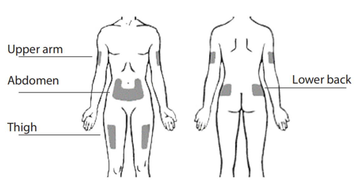 Image of body area for injection